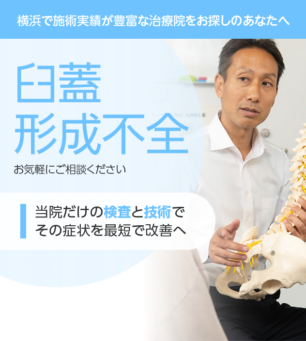 臼蓋形成不全